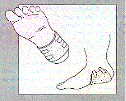 Medicazione Ligasano Lastra 59 X49 X1 Cm 14 Pz