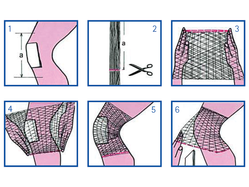 Rete Tubolare Elastica - Calibro 5 Per Ginocchio E Gamba (1 Conf.)