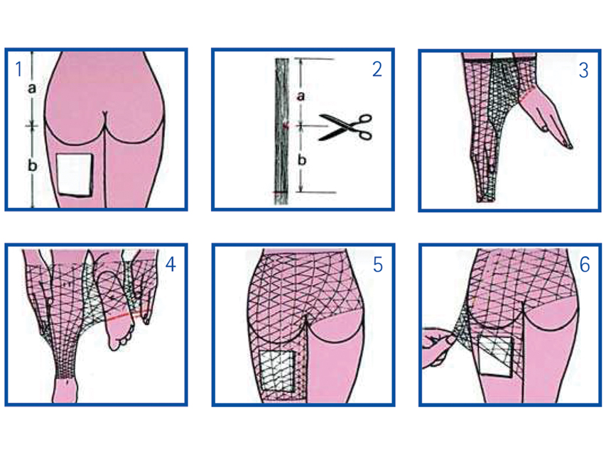 Rete Tubolare Elastica - Calibro 7 Per Bacino (1 Conf.)