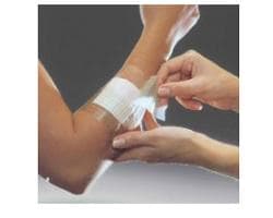 OPSITE FLEXIFIX 15X1000 1MED