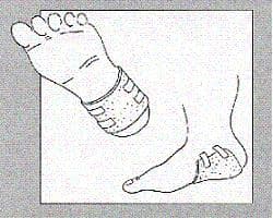 MEDICAZIONE LIGASANO LASTRA 200X100X2CM 1 PEZZO